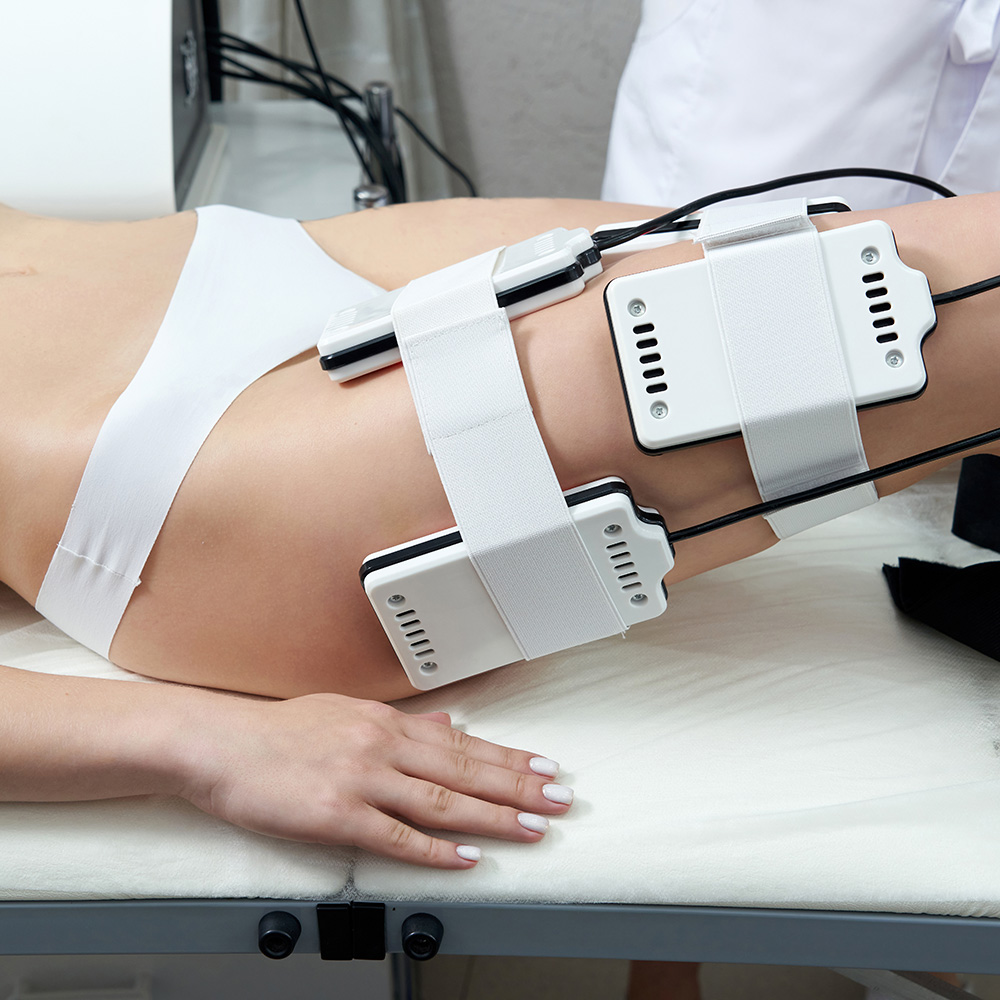 Liposlim 5 en 1: la liposucción sin cirugía