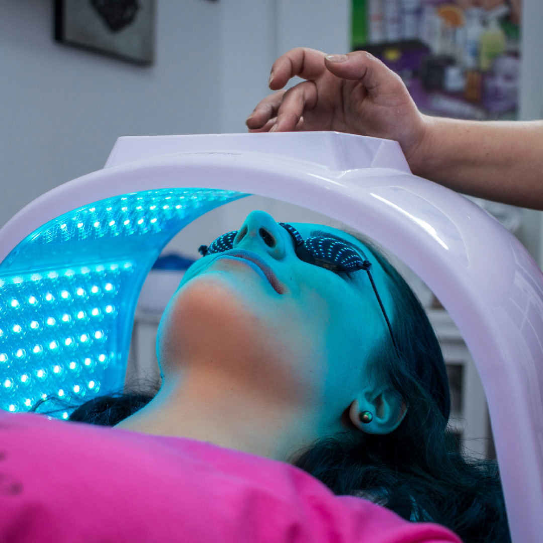 Terapia Fotodinámica